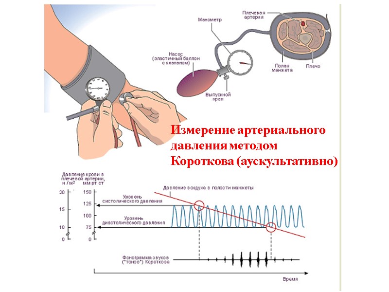 Измерение артериального давления методом Короткова (аускультативно)